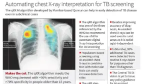 AI in Indian Healthcare Transforming TB Treatment and Telemedicine Services